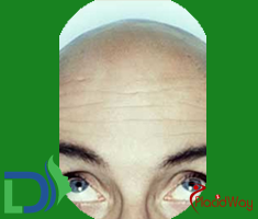 Slider image (8) Dermalife Skin and Hair Clinic